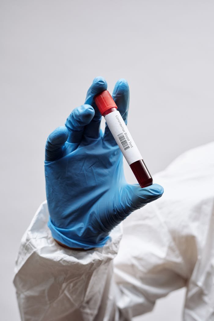 why-choose-us-02 Close-up of a gloved hand holding a blood sample in a test tube against a white background.